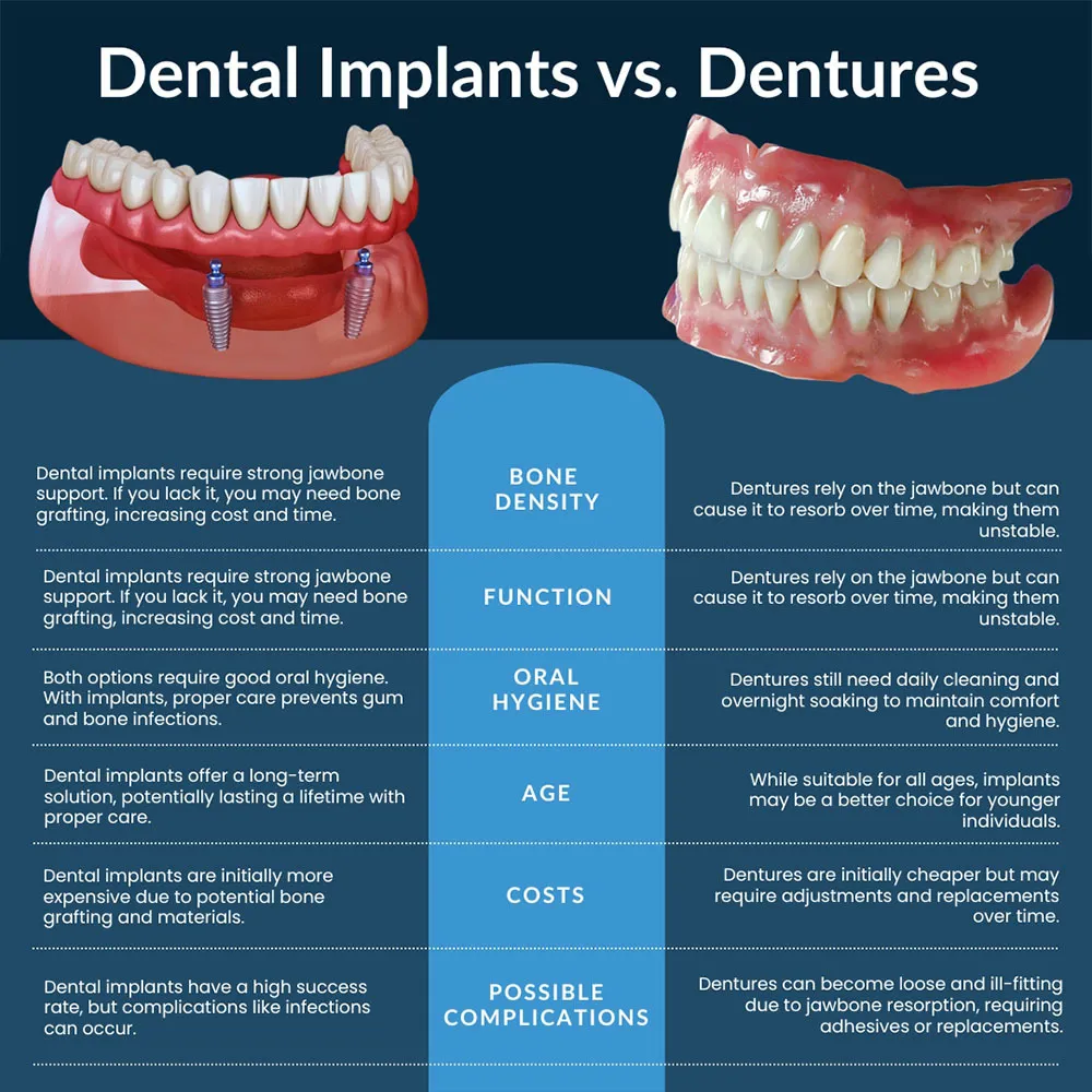 Comparison chart for dental implants